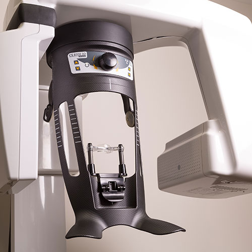 CBCT